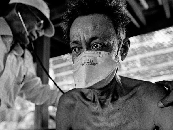 James Nachtwey: Moving photos of extreme drug-resistant TB