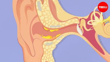 Henry Ou: What is earwax — and should you get rid of it?