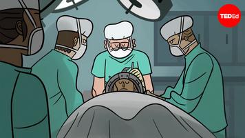 Max G. Levy: Can you transplant a head to another body?