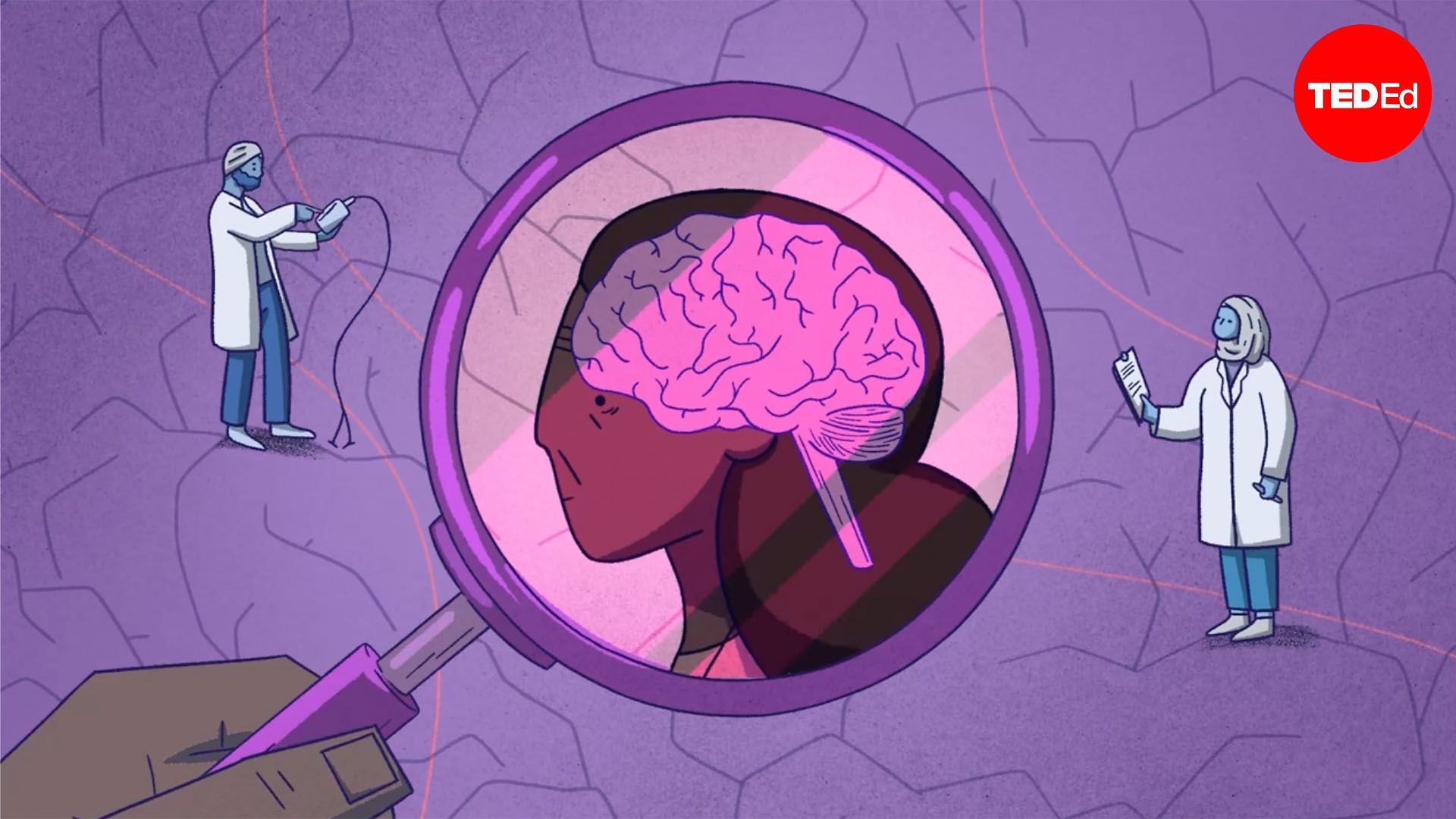 Why is Alzheimer’s disease so difficult to treat?