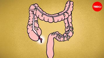 David R. Flum: What does appendix pain feel like?