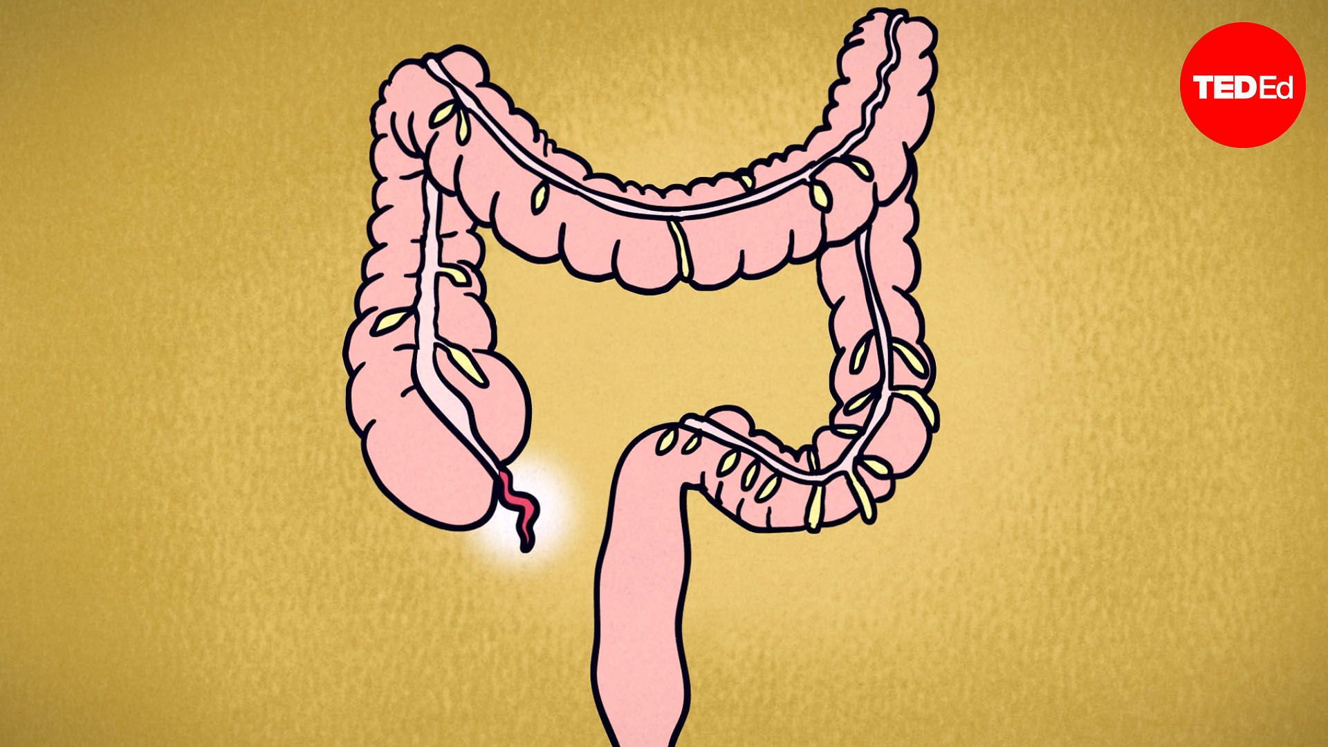 What does appendix pain feel like?
