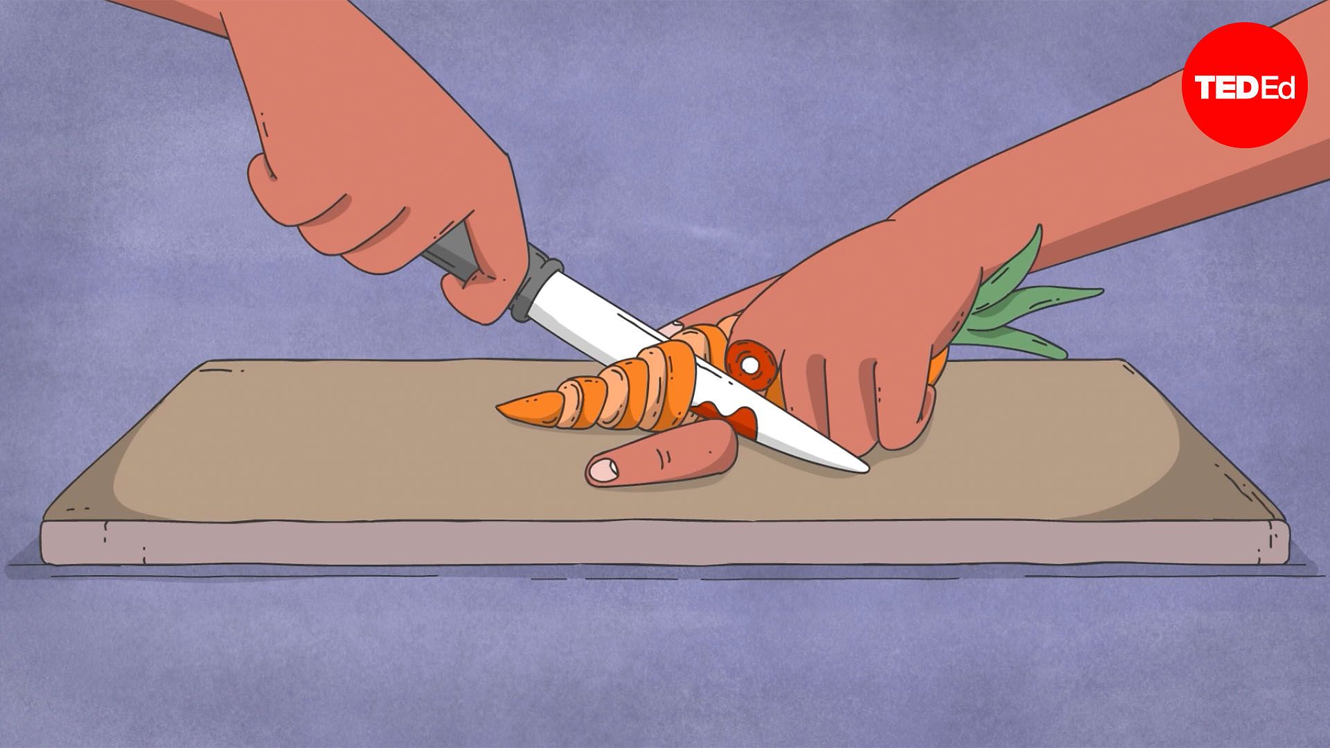 What should you do if you accidentally cut off your finger?