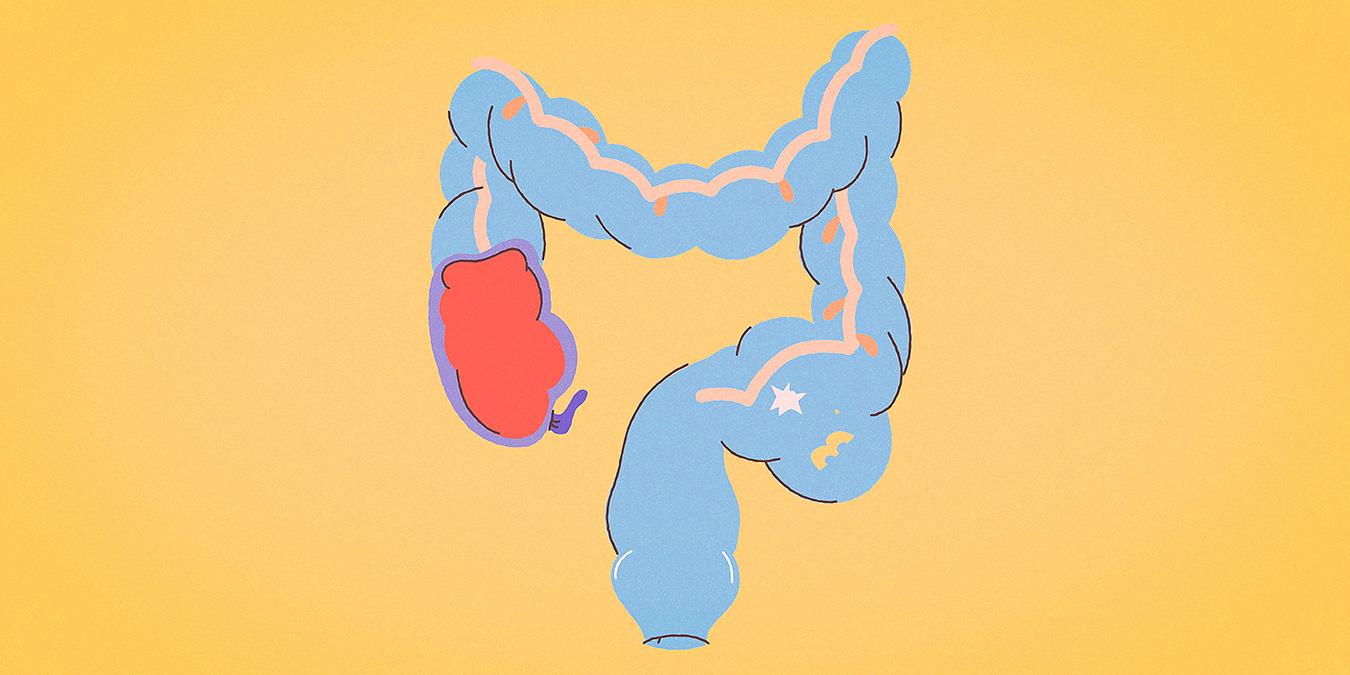 为什么你不应该担心煞风景的一天一次吗