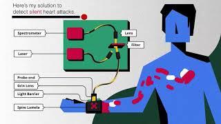 Akash Manoj: A Device To Detect Silent Heart - Attack By a 14-year old Indian