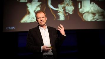 Anders Ynnerman: Visualizing the medical data explosion