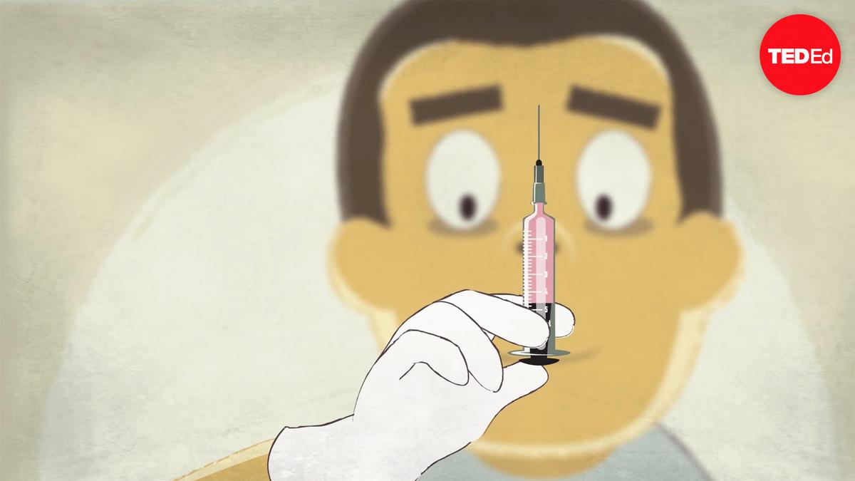 Steven zheng how does anesthesia work ted talk