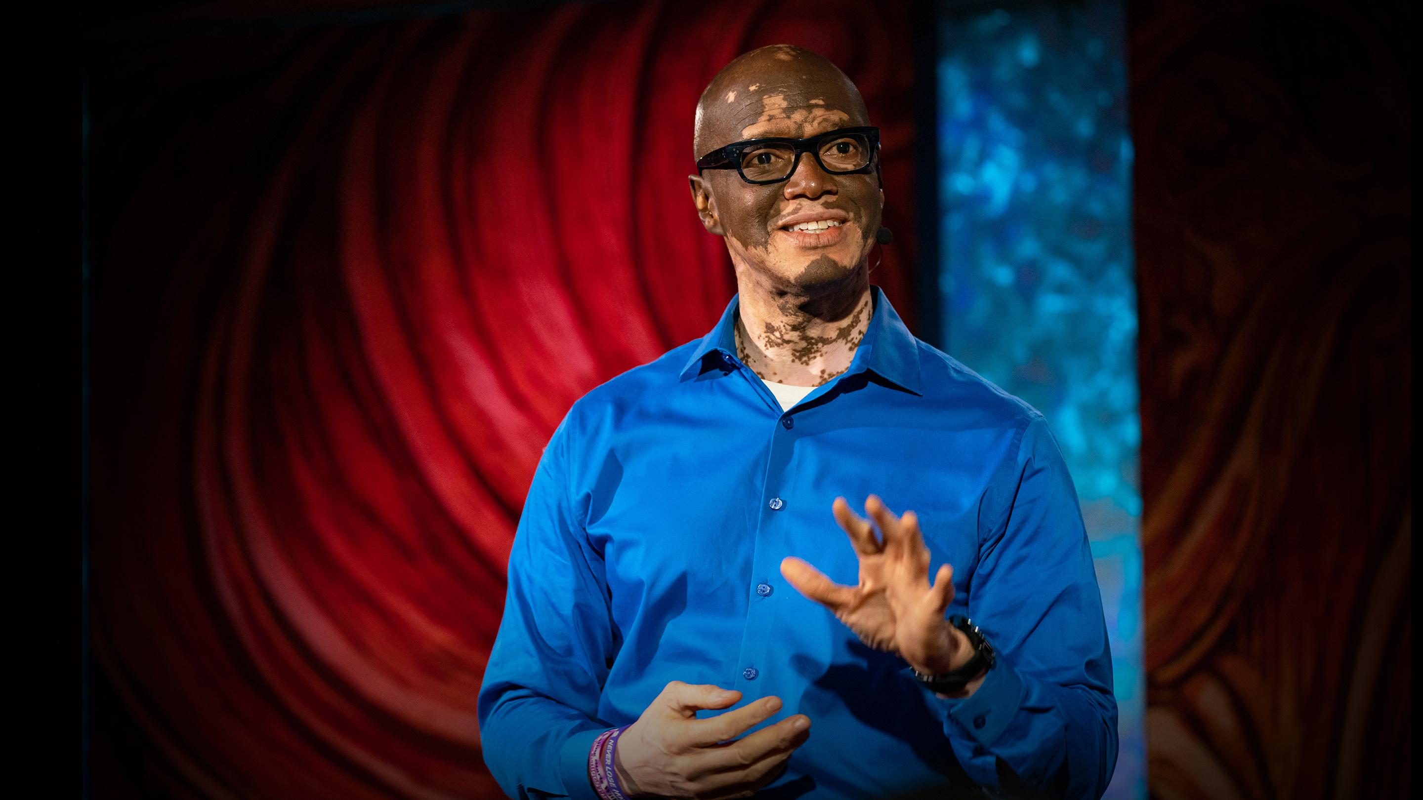 Comment j'aide les gens à comprendre le vitiligo | Lee Thomas